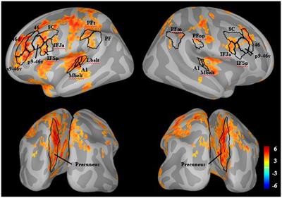 Functional connectivity and gray matter deficits within the auditory attention circuit in first-episode psychosis
